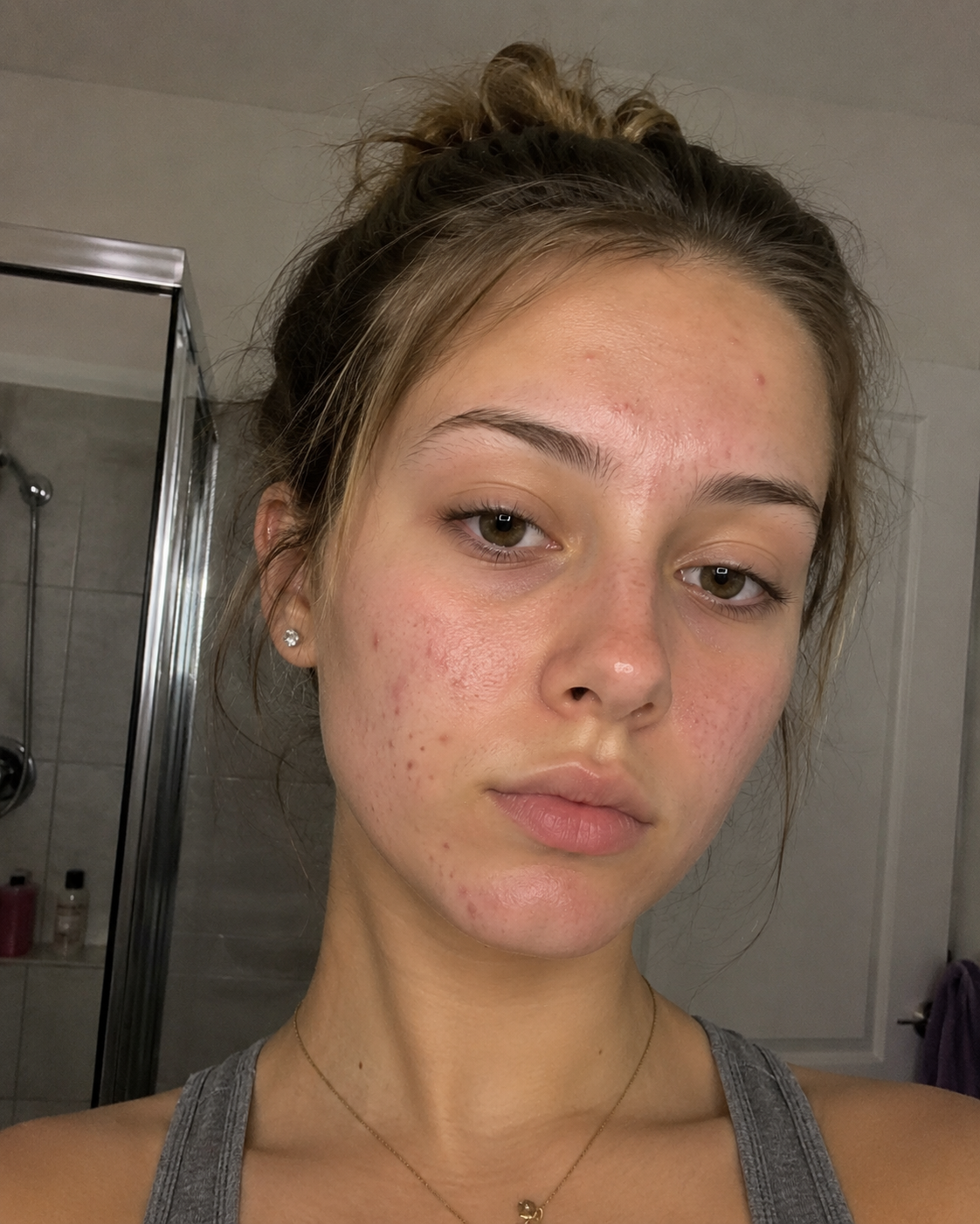 Sienna P. — before evora protocol