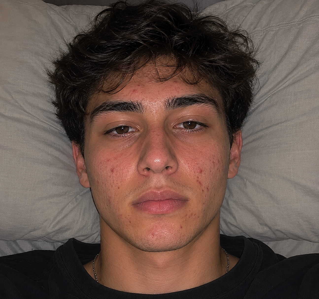 Luca M. — before evora protocol